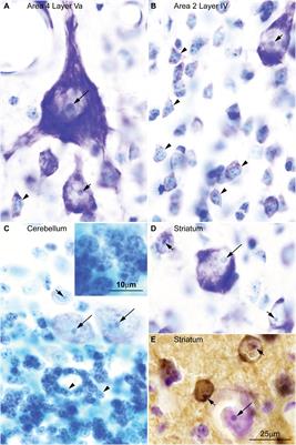 Frontiers | Parallel Development of Chromatin Patterns, Neuron